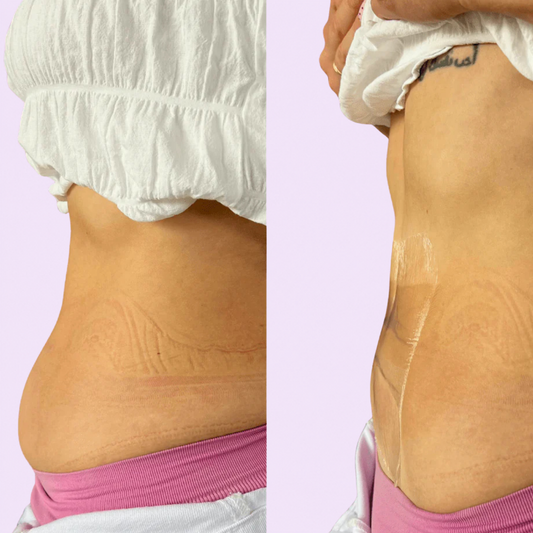 Mohonjo Tummy