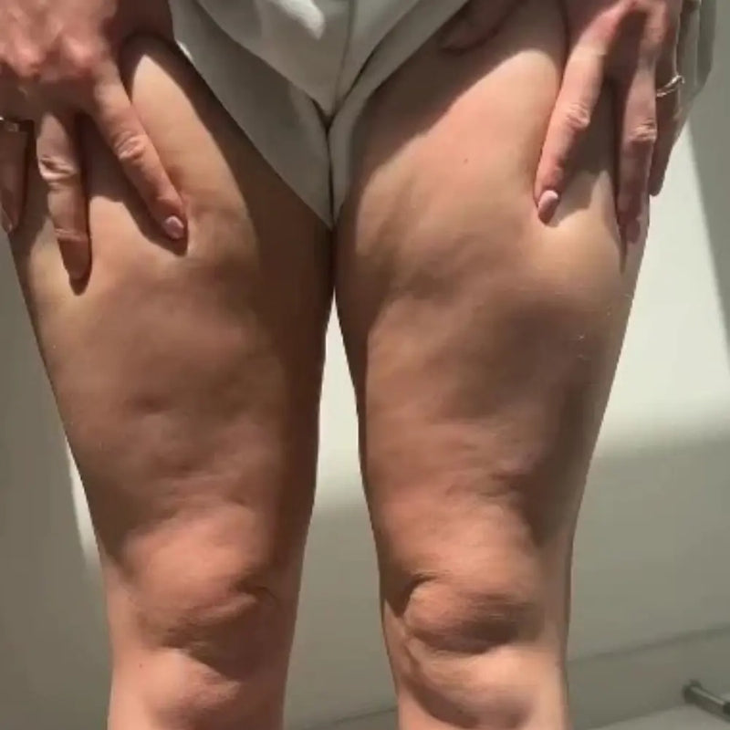After transformation
